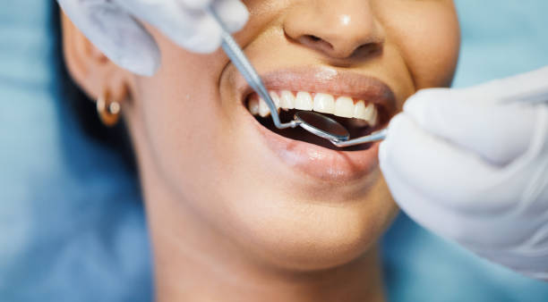 Best Teeth Whitening  in Oakwood, OH