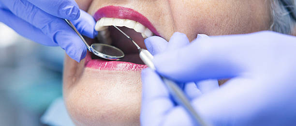 Best Chipped Tooth Repair Near Me  in Oakwood, OH